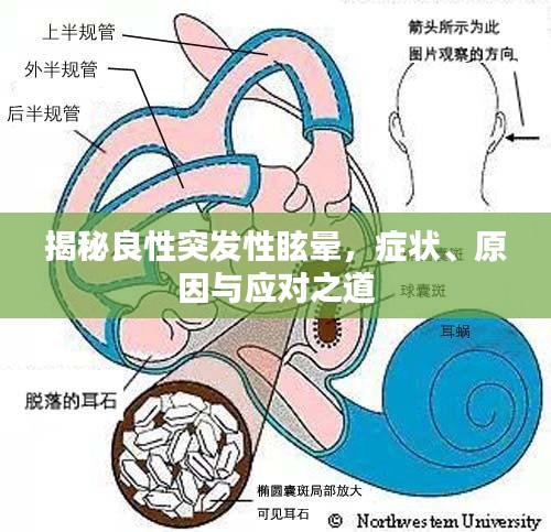 长颈鸟喙 第2页