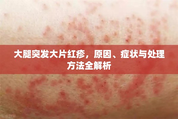 大腿突发大片红疹，原因、症状与处理方法全解析